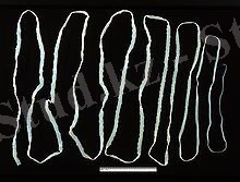 http://upload.wikimedia.org/wikipedia/commons/thumb/e/e2/Taenia_saginata_adult_5260_lores.jpg/220px-Taenia_saginata_adult_5260_lores.jpg
