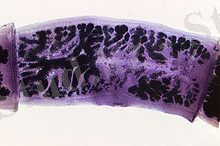 http://upload.wikimedia.org/wikipedia/commons/thumb/6/64/Taenia_solium-detailed_morphology.jpg/220px-Taenia_solium-detailed_morphology.jpg