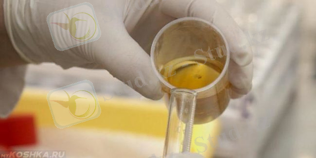 &Pcy;&iecy;&rcy;&iecy;&lcy;&icy;&vcy;&acy;&ncy;&icy;&iecy; &mcy;&ocy;&chcy;&icy; &kcy;&ocy;&tcy;&acy; &vcy; &pcy;&rcy;&ocy;&bcy;&icy;&rcy;&kcy;&ucy;