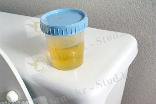 &ZHcy;&iocy;&lcy;&tcy;&ycy;&jcy; &tscy;&vcy;&iecy;&tcy; &mcy;&ocy;&chcy;&icy; &kcy;&ocy;&tcy;&acy; &vcy; &bcy;&acy;&ncy;&ocy;&chcy;&kcy;&iecy;