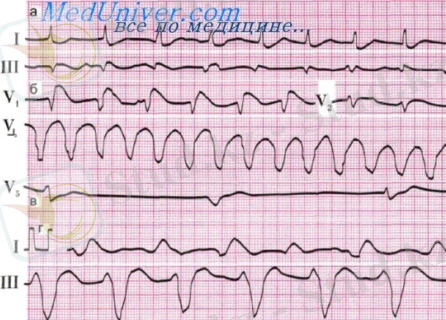 Картинки по запросу экг это