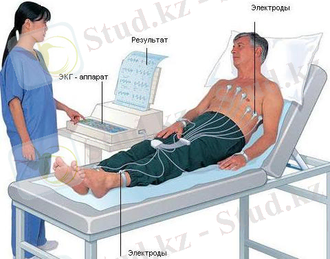 Картинки по запросу экг это