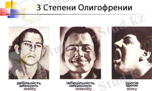 Картинки по запросу олигофрения