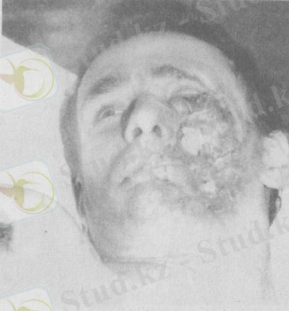 c:\documents and settings\открыть\local settings\temporary internet files\content.word\1 035.jpg