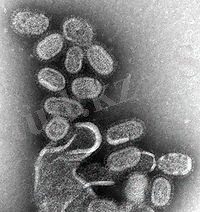 http://upload.wikimedia.org/wikipedia/commons/thumb/a/a4/EM_of_influenza_virus.jpg/200px-EM_of_influenza_virus.jpg