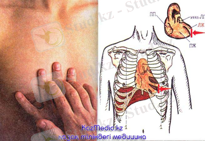 жүрек перкуссиясы