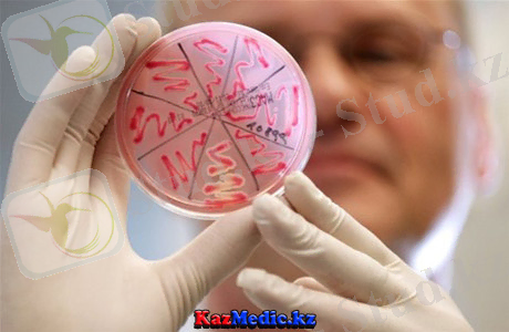 ÐÐ°ÑÑÐ¸Ð½ÐºÐ¸ Ð¿Ð¾ Ð·Ð°Ð¿ÑÐ¾ÑÑ ÐºÐ»ÐµÐ±ÑÐ¸ÐµÐ»Ð»Ð°Ð»Ð°Ñ