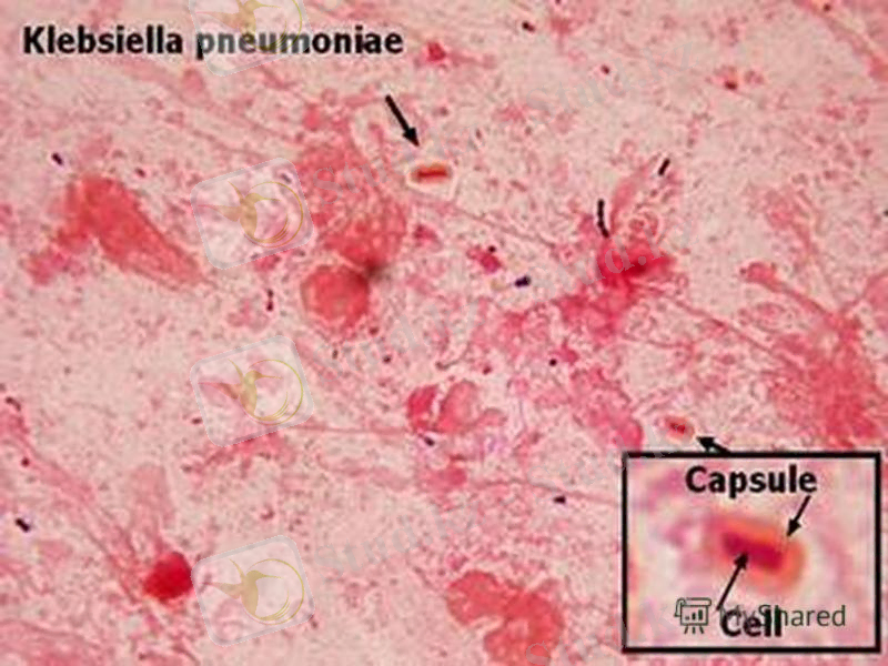 ÐÐ¾ÑÐ¾Ð¶ÐµÐµ Ð¸Ð·Ð¾Ð±ÑÐ°Ð¶ÐµÐ½Ð¸Ðµ