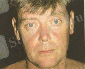 C:\Documents and Settings\Admin\Рабочий стол\сары ауру\43.jpg