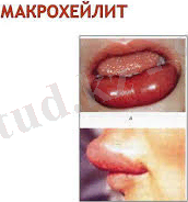 Без названия.jpg