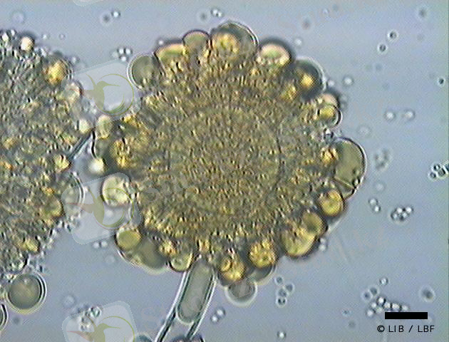 http://dc343.4shared.com/img/TeI9amx-/s3/1232ff0c398/Aspergillus_ochraceus