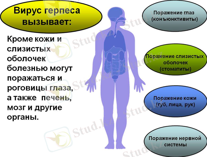 http://900igr.net/datas/meditsina/Gerpes/0012-012-Virus-gerpesa-vyzyvaet.jpg