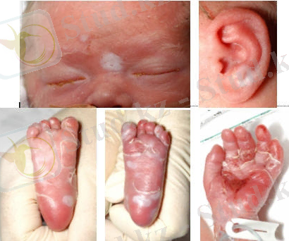 Картинки по запросу мерез ауруы