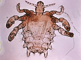 Pthirus pubis - crab louse.jpg