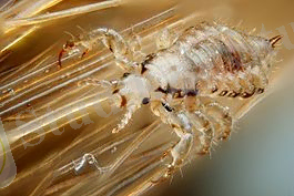 Male human head louse.jpg