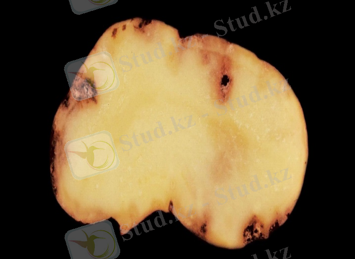 Картинки по запросу "Ditylenchus destructor"