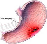 D:\Нурхан 4-курс\Без названия (1).jpg
